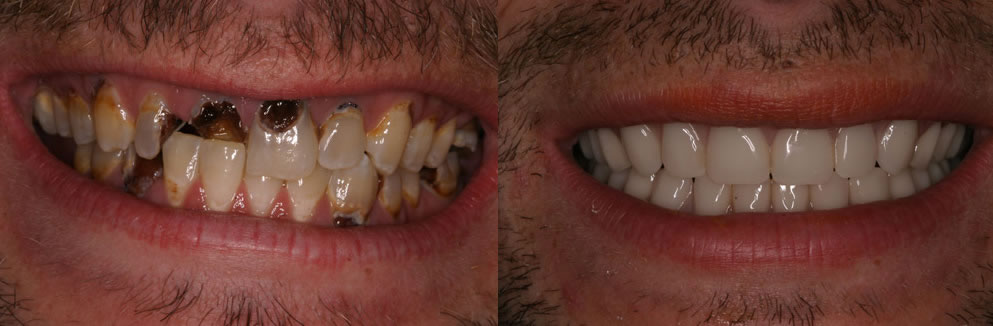 FOTOD: Vaata, mida tänapäva hambaarstid suudavad teha