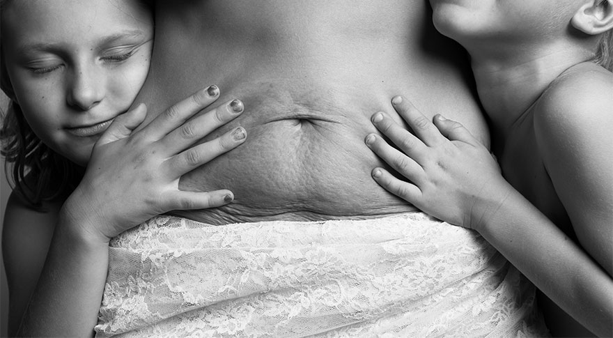 FOTOD: Vaata, kui palju muutuvad emade kehad pärast sünnitust