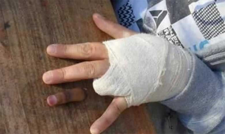 FOTOD: Sassis tüüp - mees vedas kihla, et lõikab sõrme maha koti kanepi ja 100 dollari eest