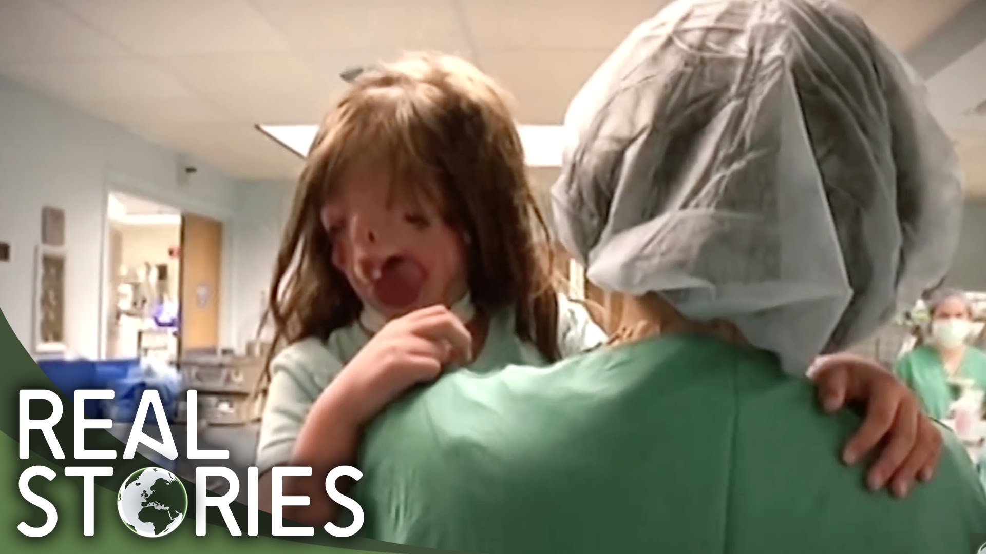 VIDEO: Juliana Wetmore - tüdruk, kes sündis ilma näota