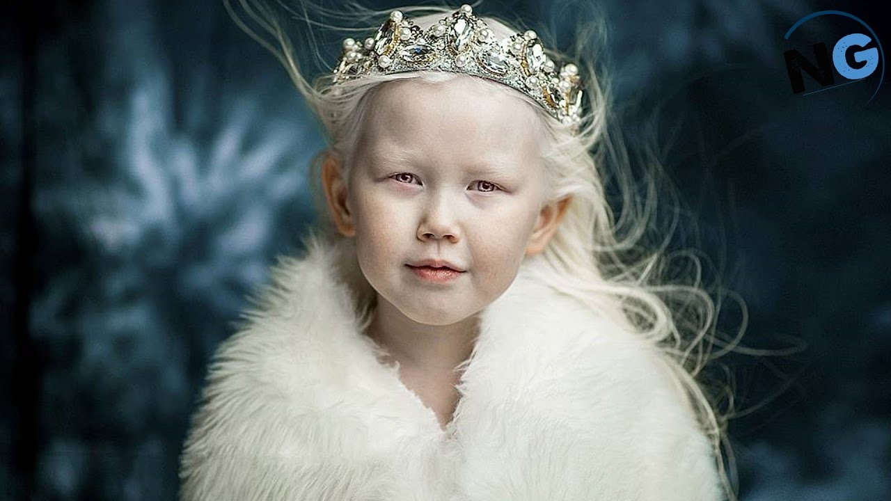 VIDEO: 8-aastane Siberi albiino hämmastab oma ebatavalise iluga modelliagentuure