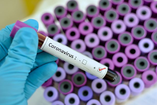 11.11.2020 – Viimase ööpäevaga analüüsiti Eestis väga suur arv koroonaviiruse teste