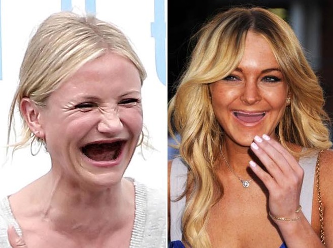 FOTOD: MIllised näeksid välja kuulsused, kui neil ei oleks hambaid