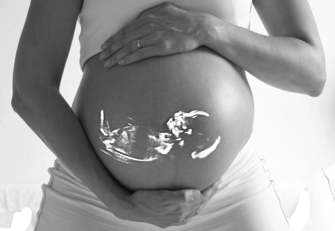pregnant, baby, echo, ultrasound, pregnancy, belly, family, expecting, mother, woman, fetus, ultrasound, ultrasound, ultrasound, ultrasound, fetus, fetus, fetus, fetus, fetus